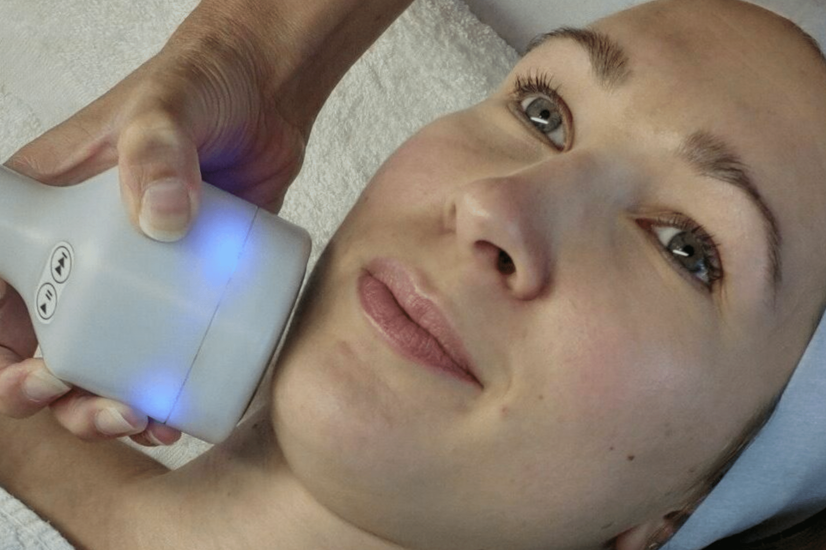 10 Benefits of a CryoFacial, aka Frotox