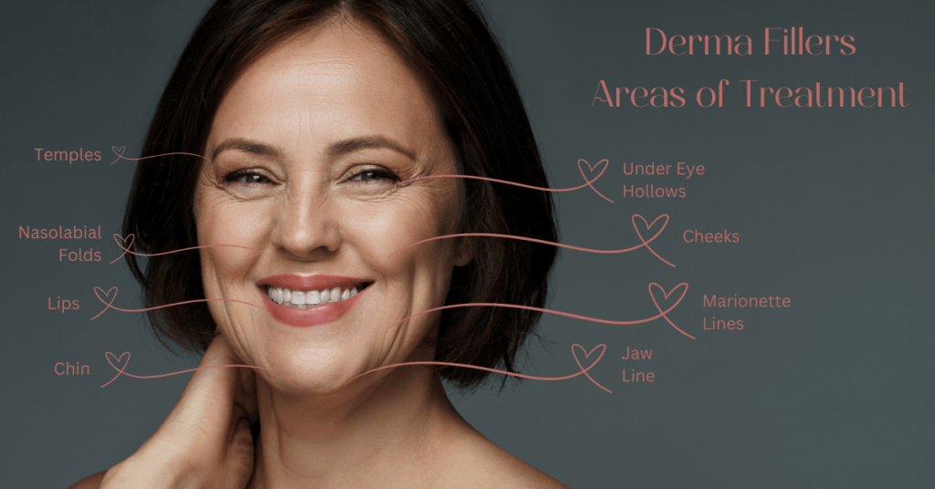 Derma Fillers can help lift cheeks, plump lips, define your chin and jaw line, improve bags under your eyes and so much more in Clearwater.