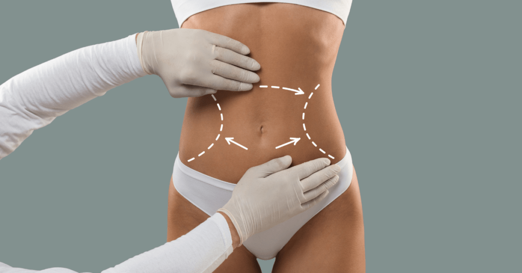 Non Invasive Body Contouring Clearwater Florida