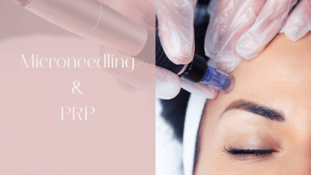 Microneedling Clearwater | Love Your Body