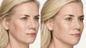 Anti-Aging Treatments at Medical Spa Clearwater _ Love Your Body
