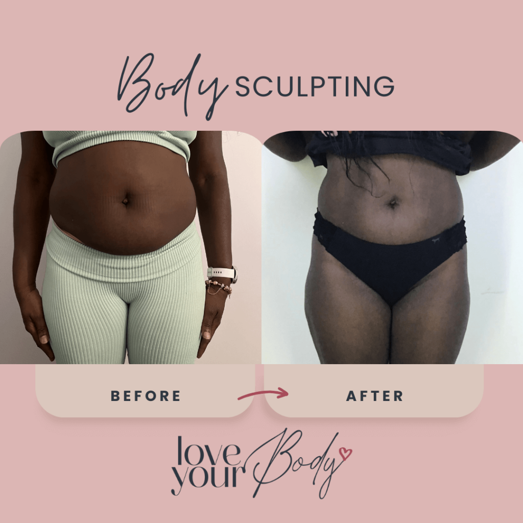 Body Sculpting Before and After at Love Your Body in Clearwater 2