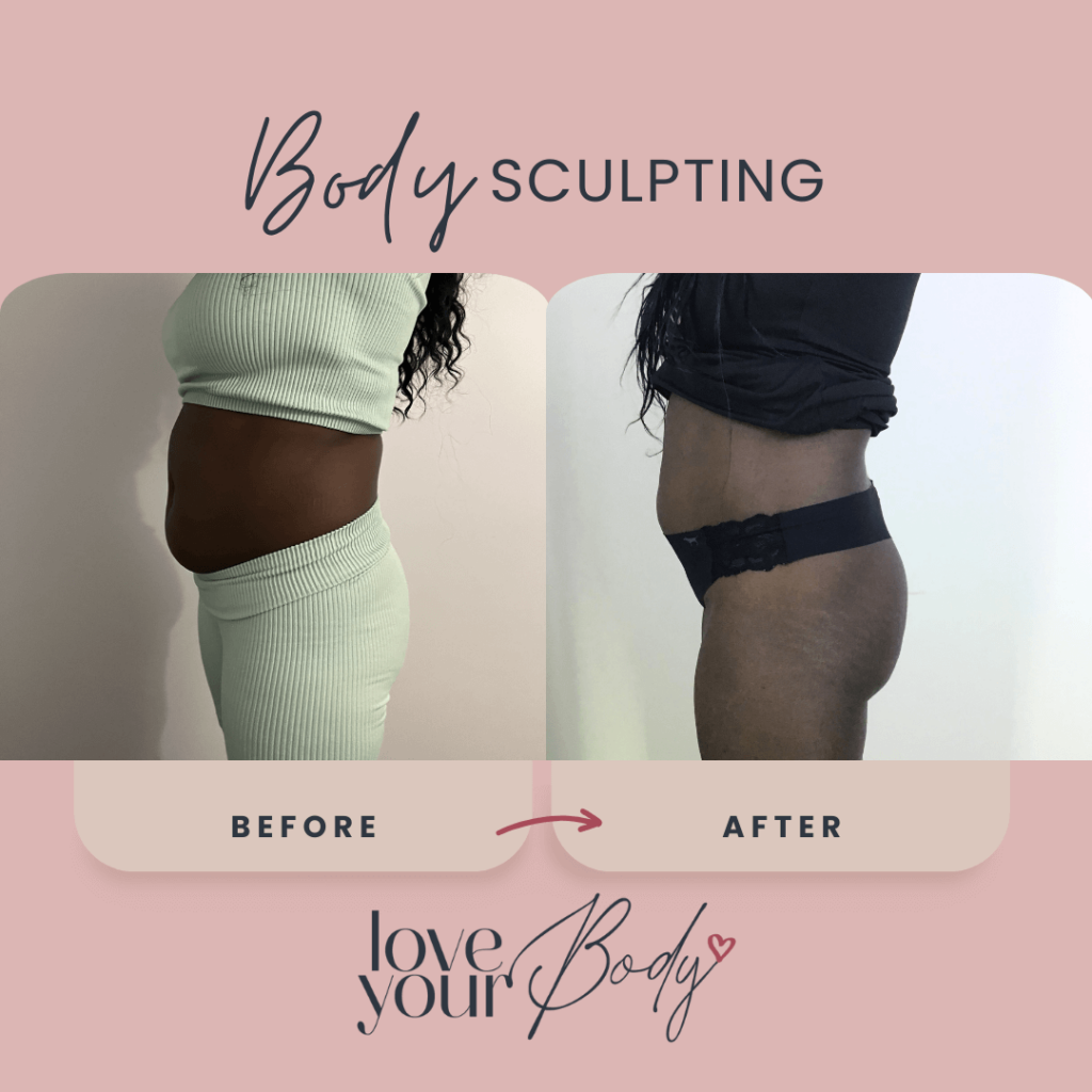 Body Sculpting Before and After at Love Your Body in Clearwater 3