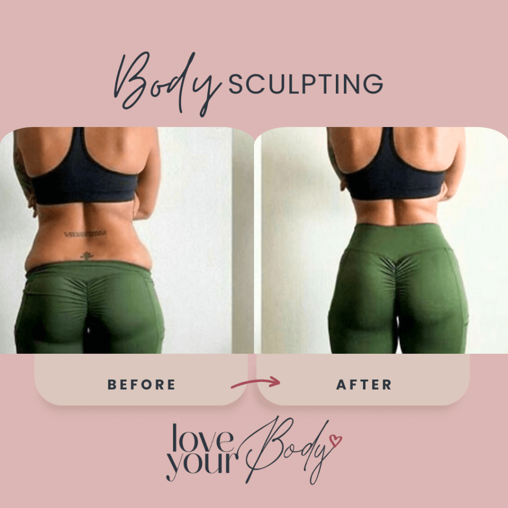 Body Sculpting Before and After at Love Your Body in Clearwater 8