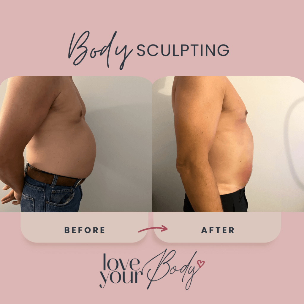 Electromuscular Stimulation Treatment Results Clearwater