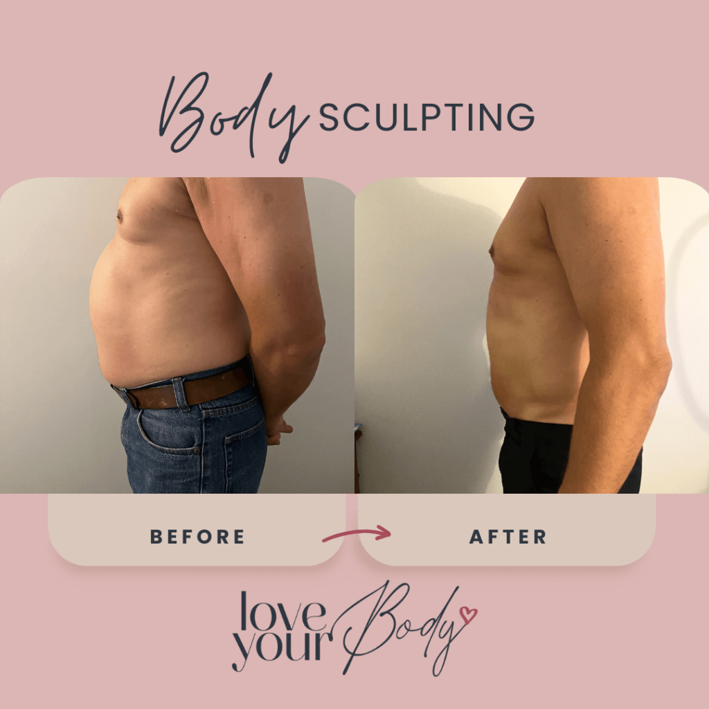 Electromuscular Stimulation Treatment Results Clearwater 2