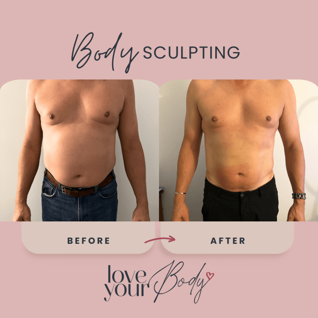 Electromuscular Stimulation Treatment Results Clearwater 3